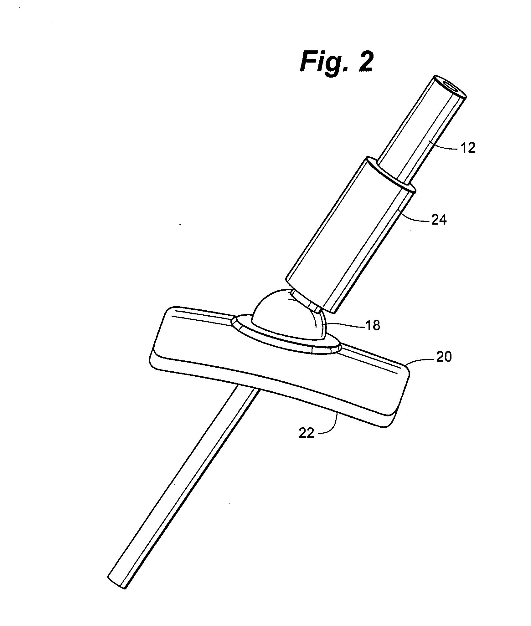 Anchorless non-invasive force dissipation system for orthopedic instrumentation