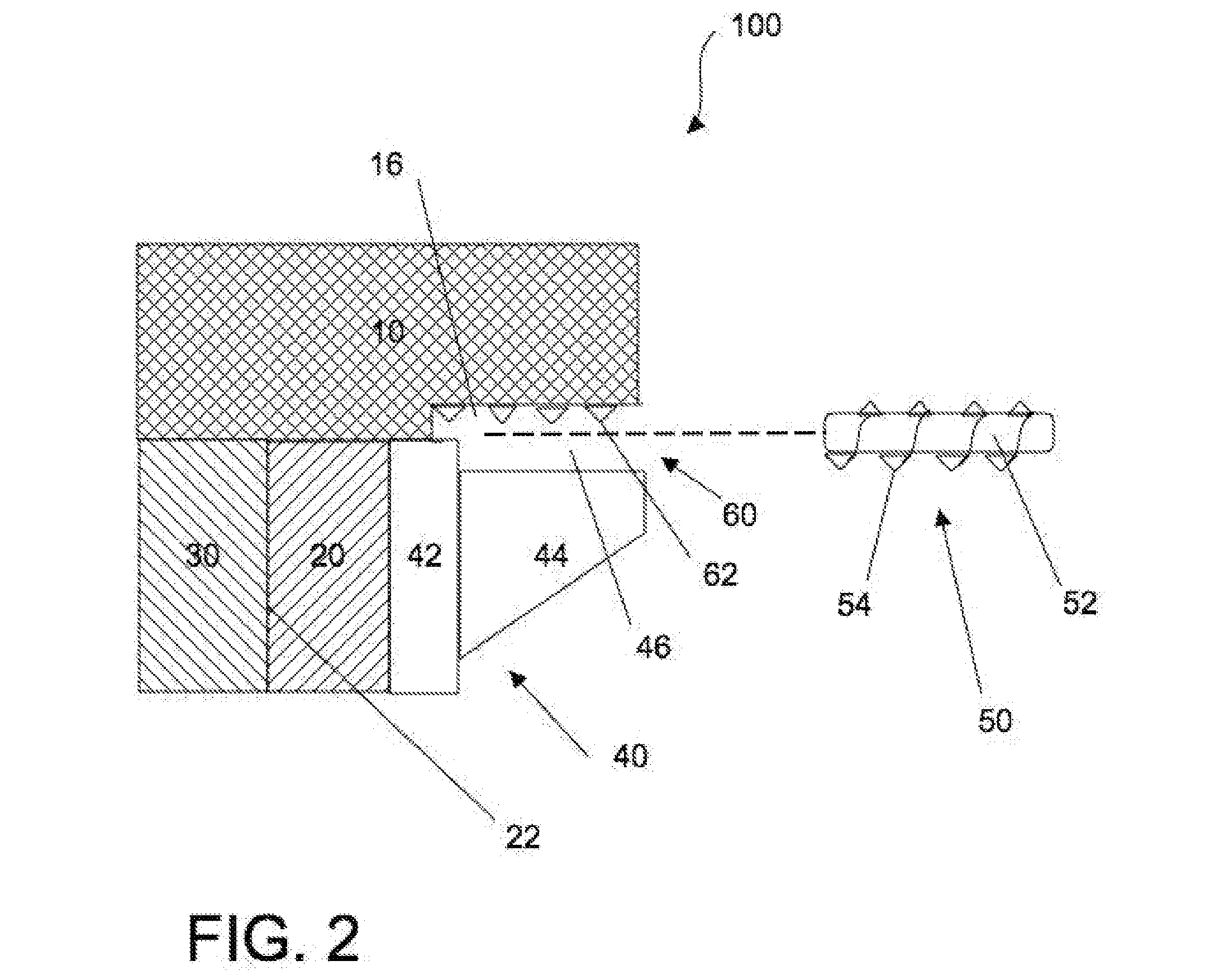 Tensioning device