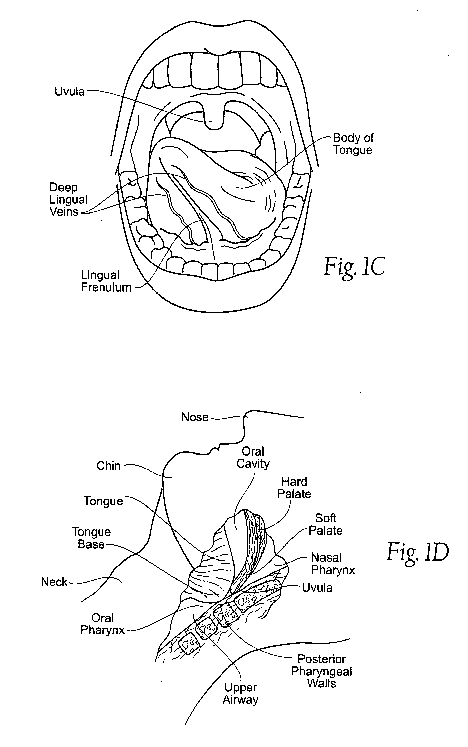 Implantable devices, systems, and methods for maintaining desired orientations in targeted tissue regions