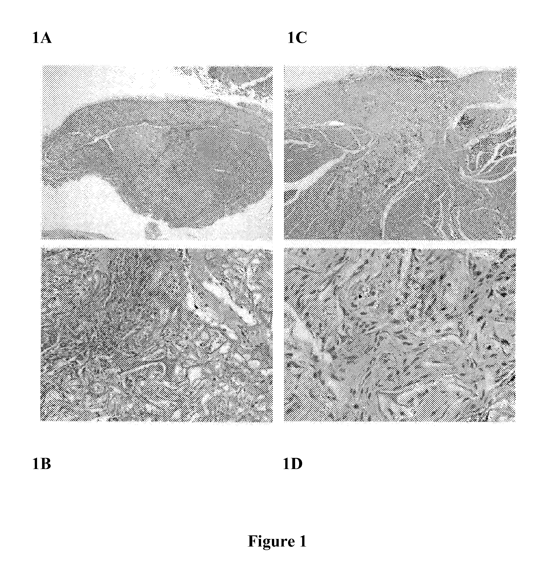 Flowable wound matrix and its preparation and use