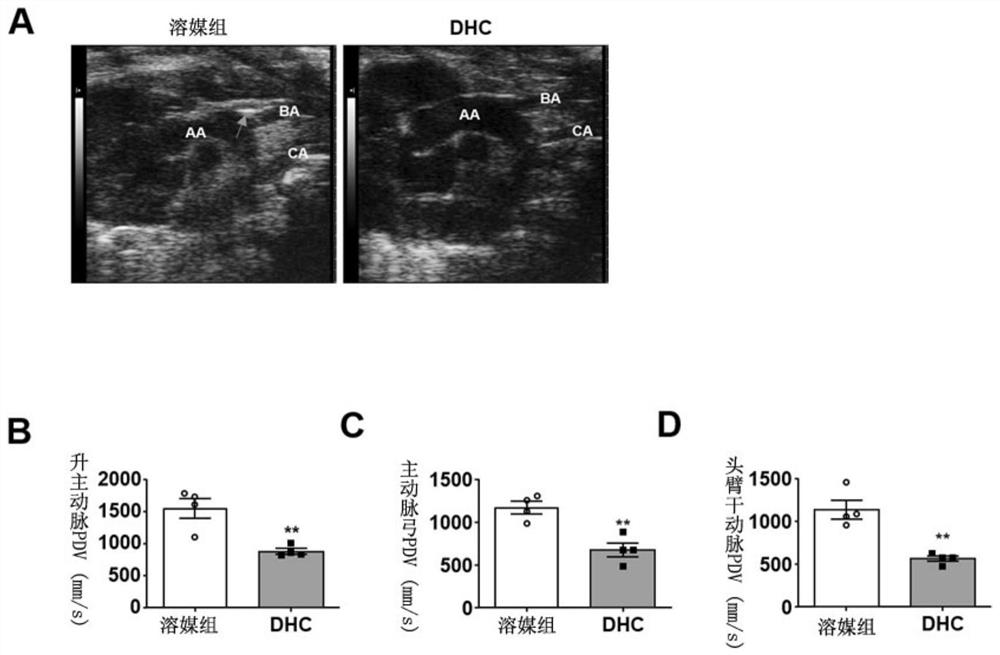 Application of DHC (dehydrocorydaline) in preparation of preparation for treating atherosclerosis