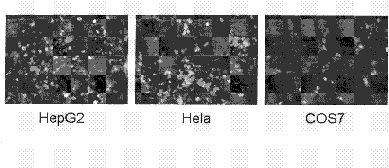 Compound of tumor targeted nonviral gene vector and plasmid DNA and preparation method thereof