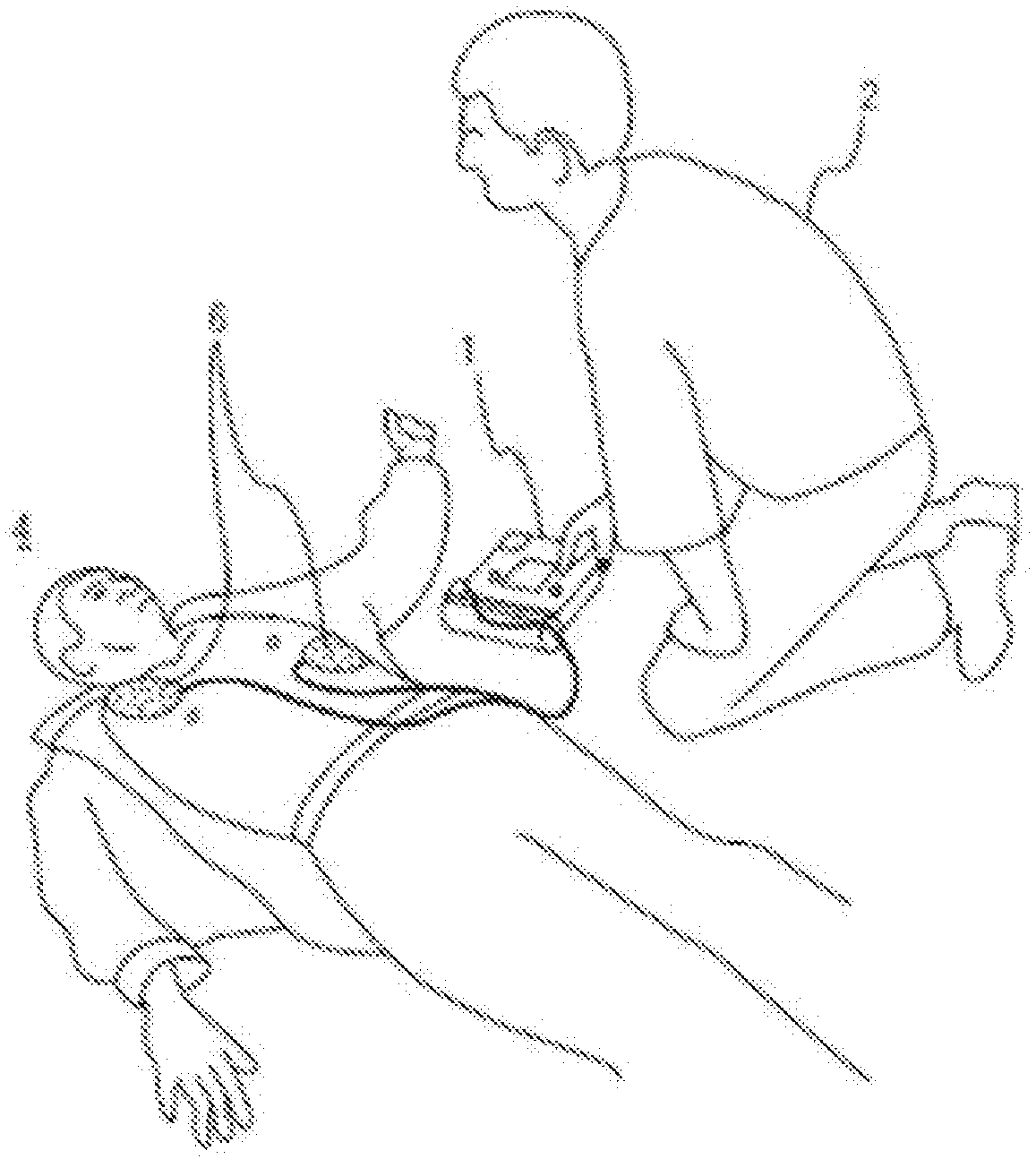 Apparatus for reversing a shock decision in an automated external defibrillator