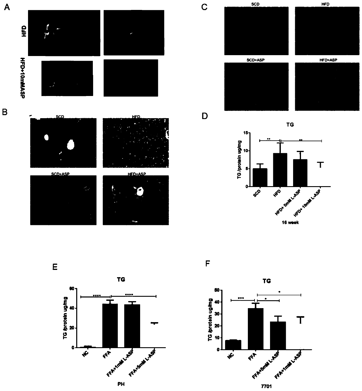 Application of aspartic acid in preparation of medicine for preventing and treating nonalcoholic fatty liver disease