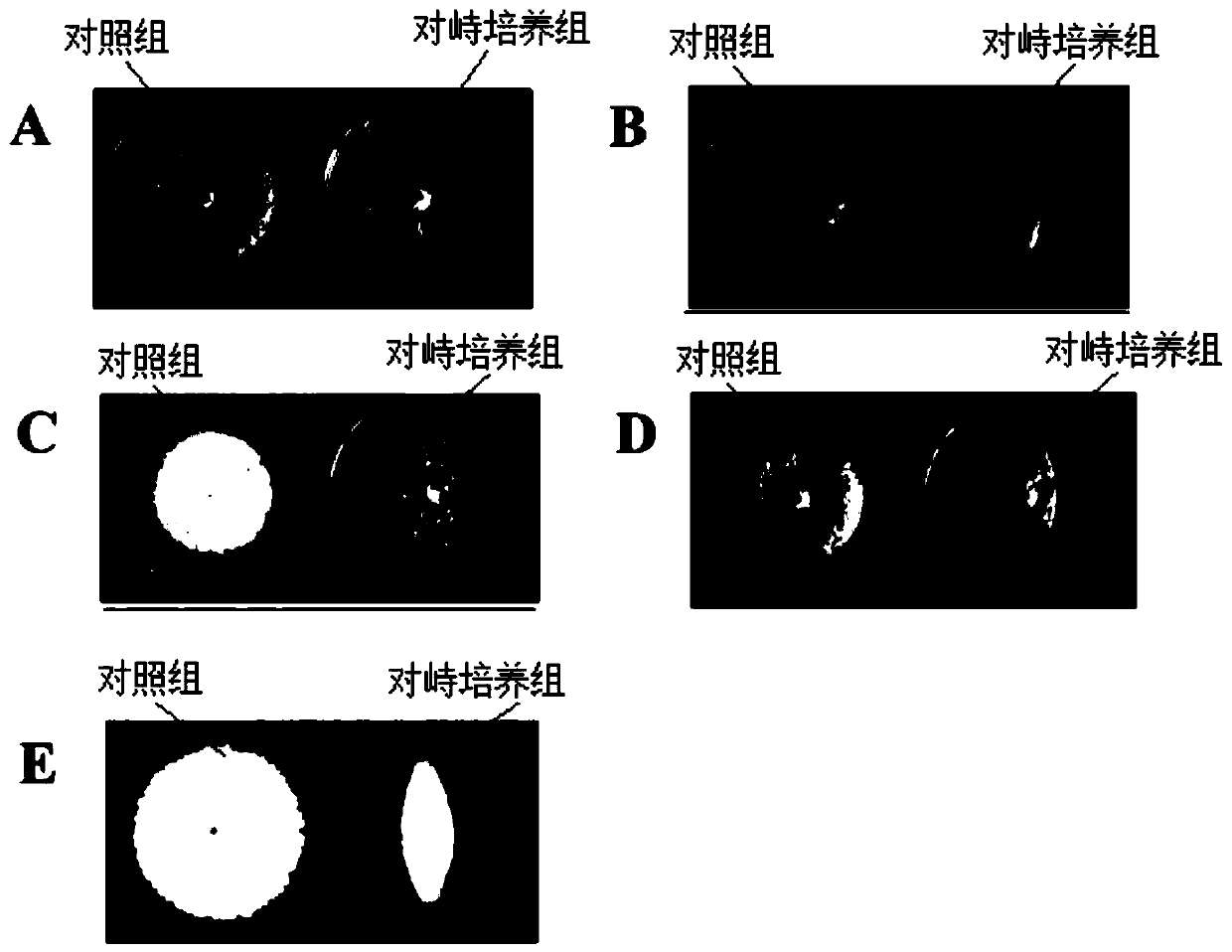 Bacterial strain and application thereof in prevention and treatment of fusarium wilt