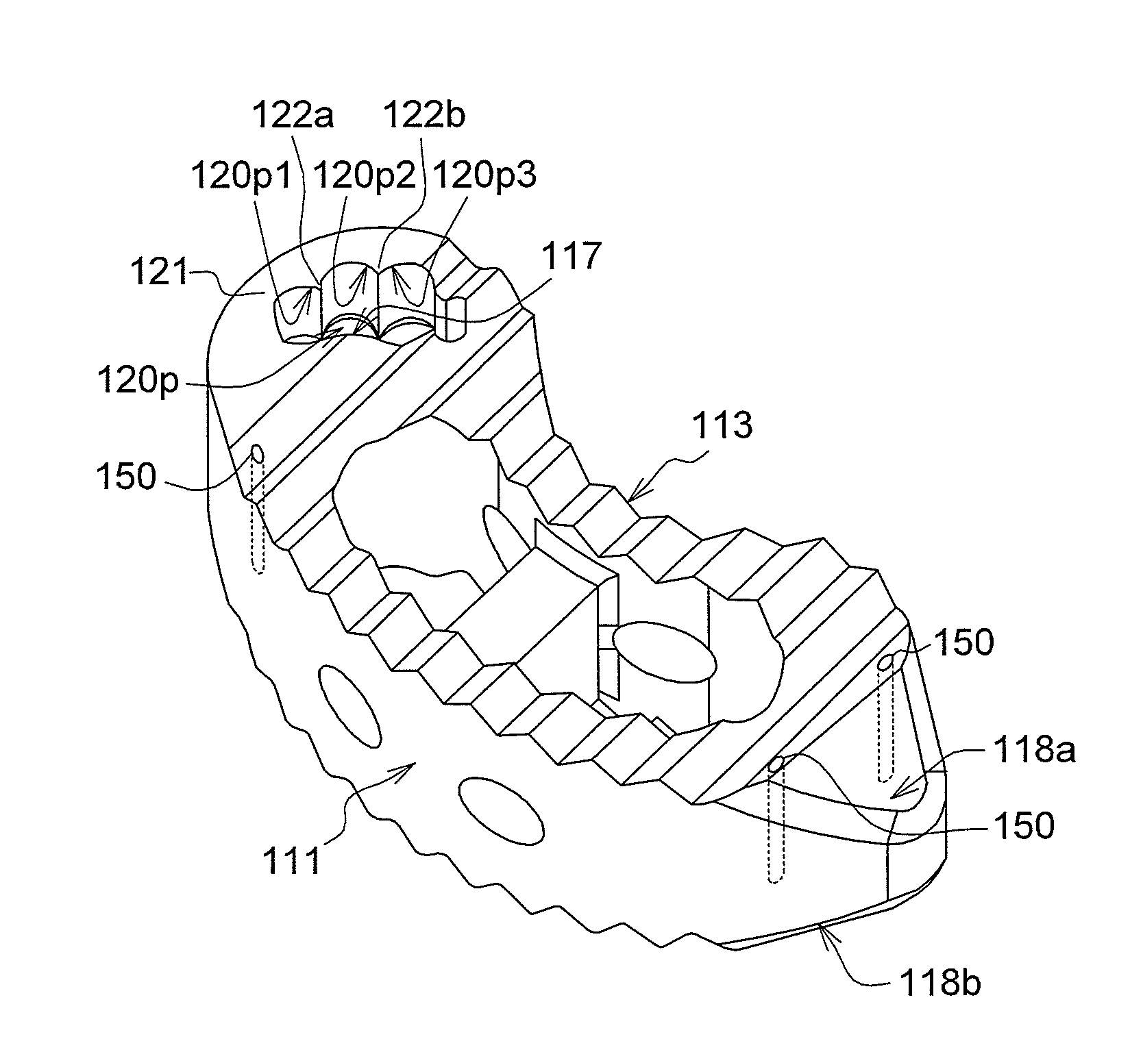 Intervertebral cage and implanting apparatus and operating method thereof