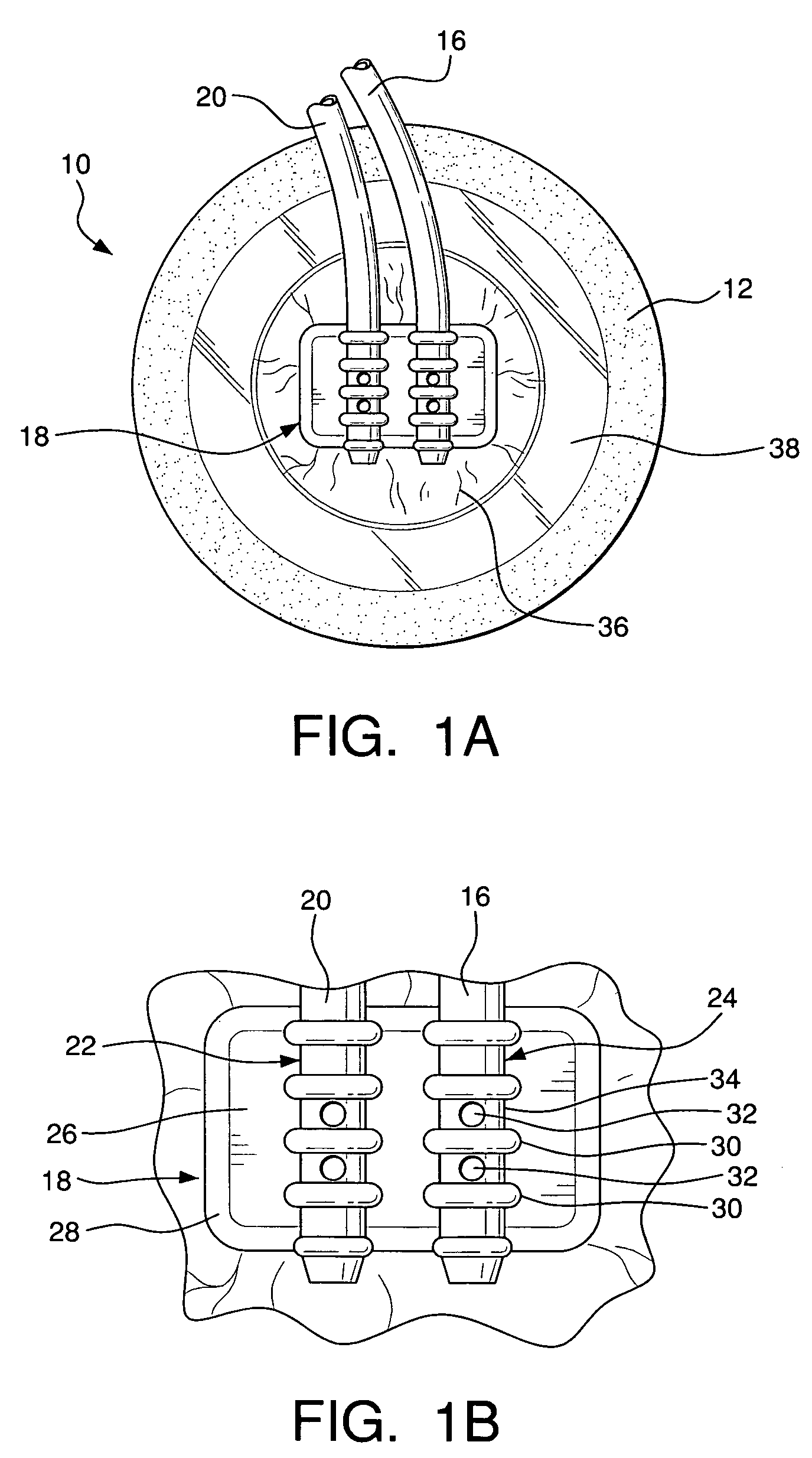 Tube attachment device for wound treatment