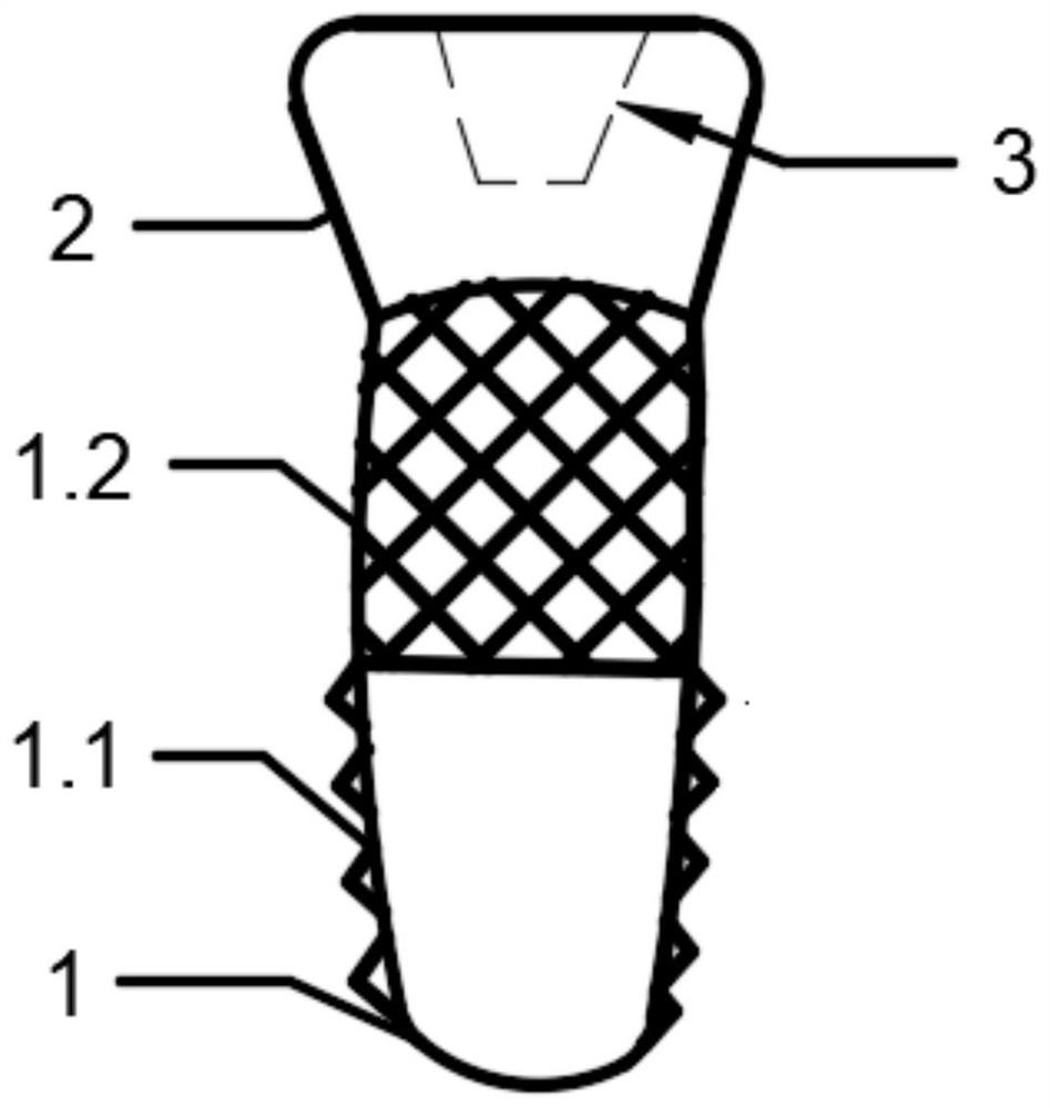 A kind of integrated dental implant and preparation method thereof