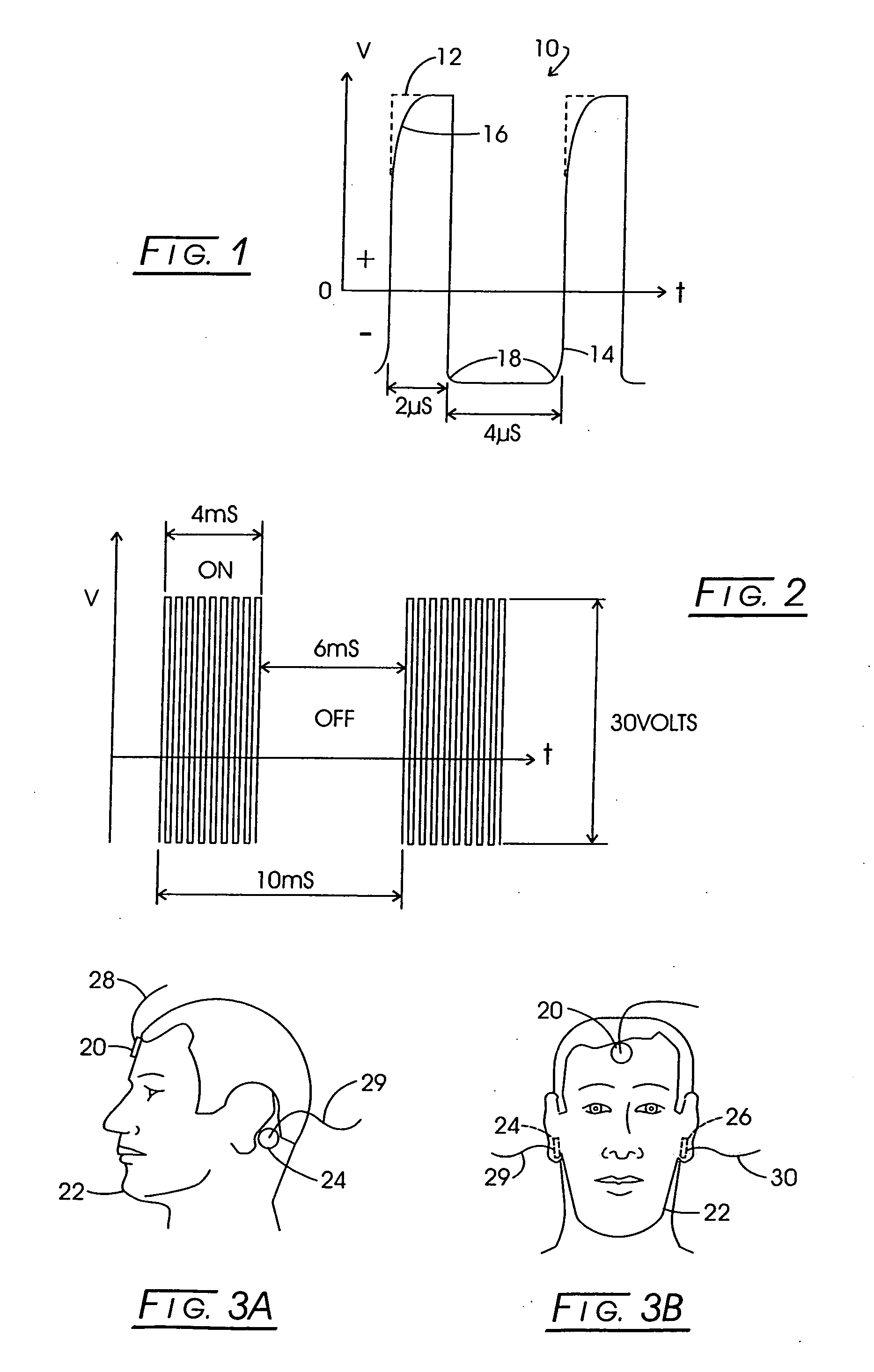 Electrical stimulation of tissue for therapeutic and diagnostic purposes