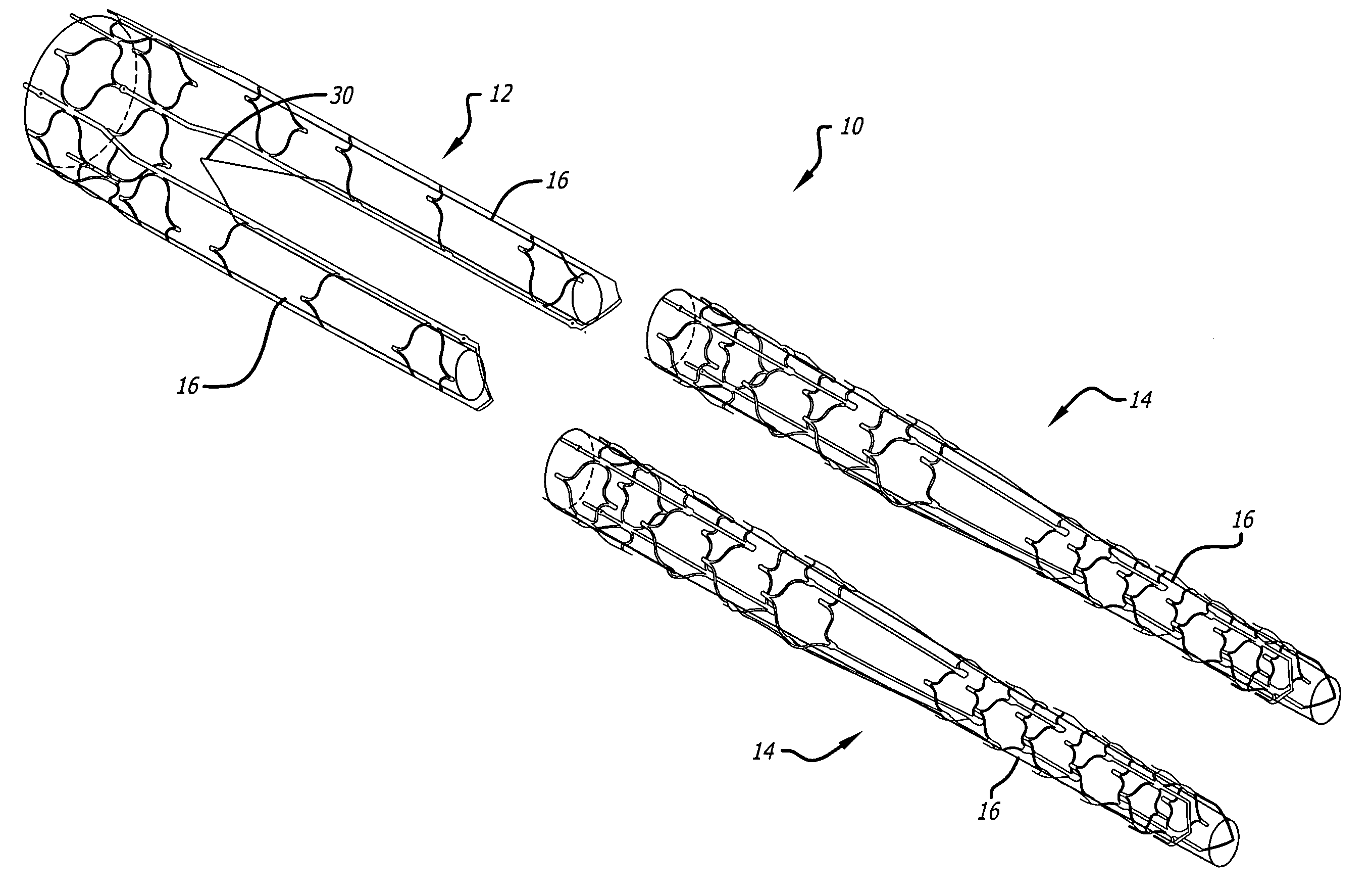 Universal length sizing and dock for modular bifurcated endovascular graft
