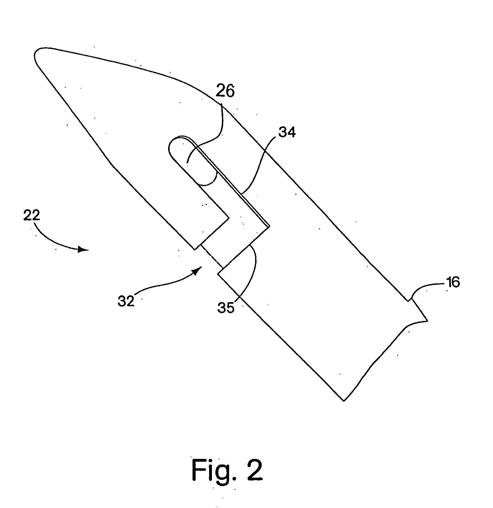 Methods and devices for the treatment of urinary incontinence