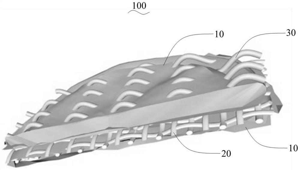 Attached bioprosthetic valve and preparation method thereof