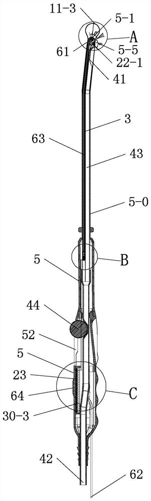 Direct-view induced abortion uterine curettage device and system