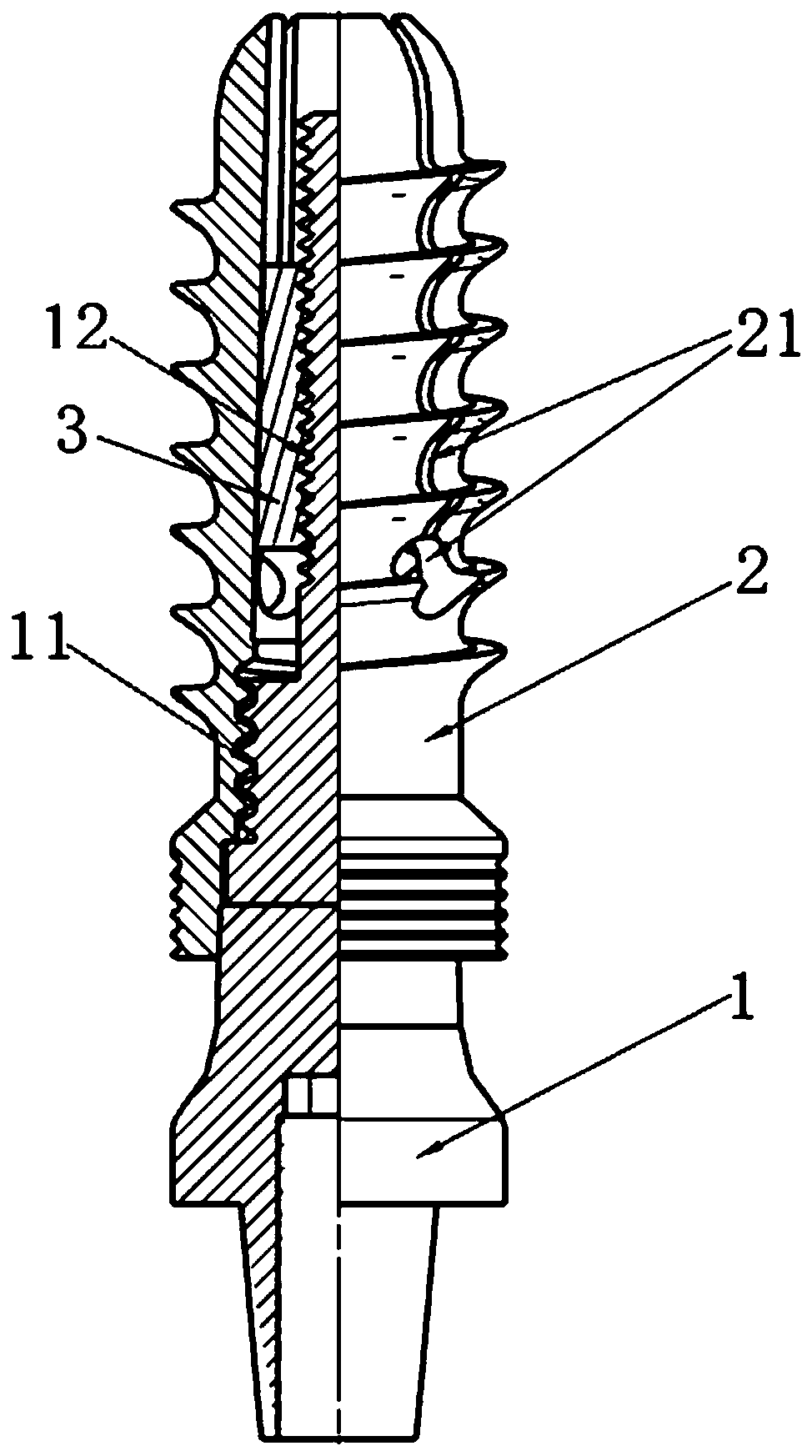 Expanding type tooth implantation device based on differential thread transmission