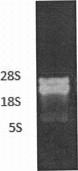 Method for extracting total RNA from leechee