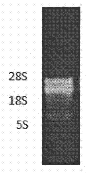 Method for extracting total RNA from leechee