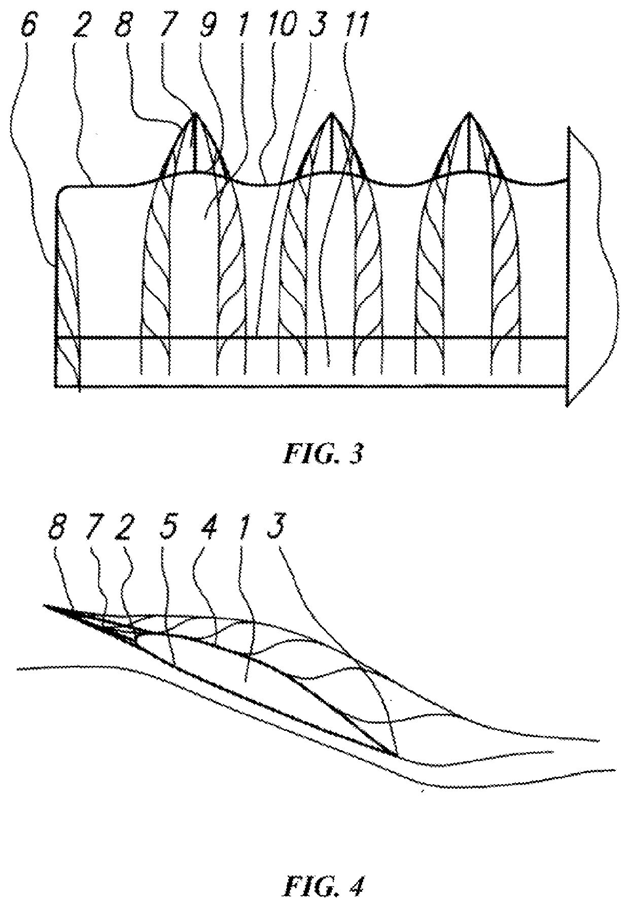 Aerodynamic surface of an aircraft