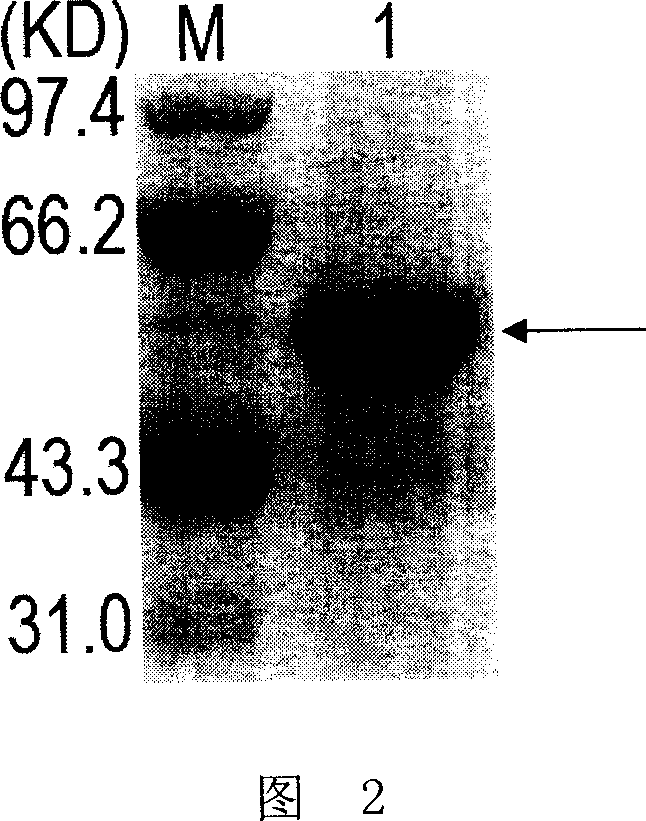 Enzyme linked immunoreaction reagent kit for detecting rabies virus