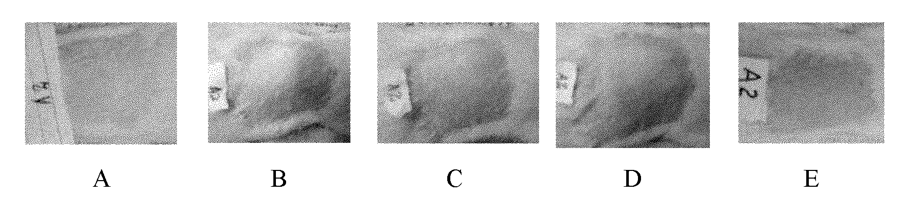 Hydrogel dressing containing recombinant human epidermal growth factor and preparation method and application thereof