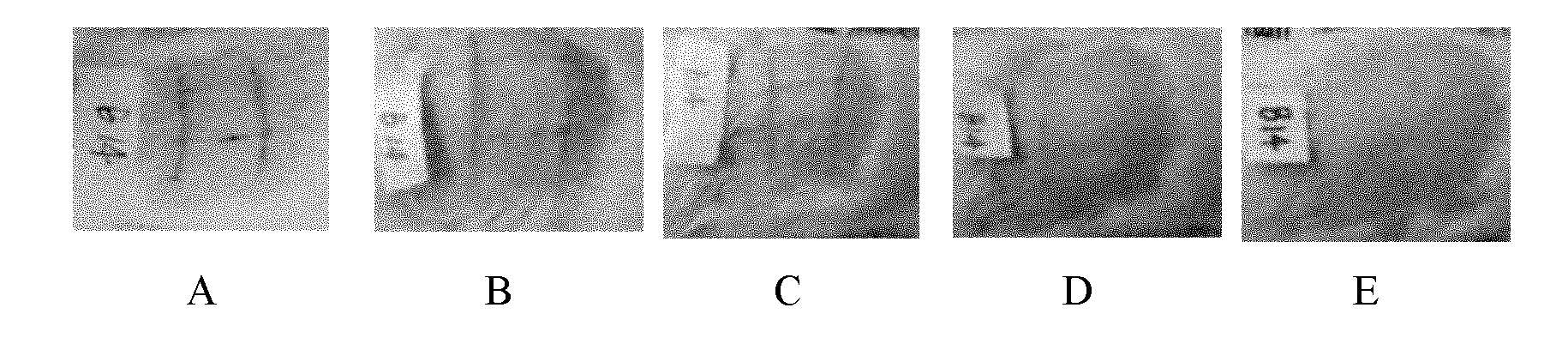 Hydrogel dressing containing recombinant human epidermal growth factor and preparation method and application thereof