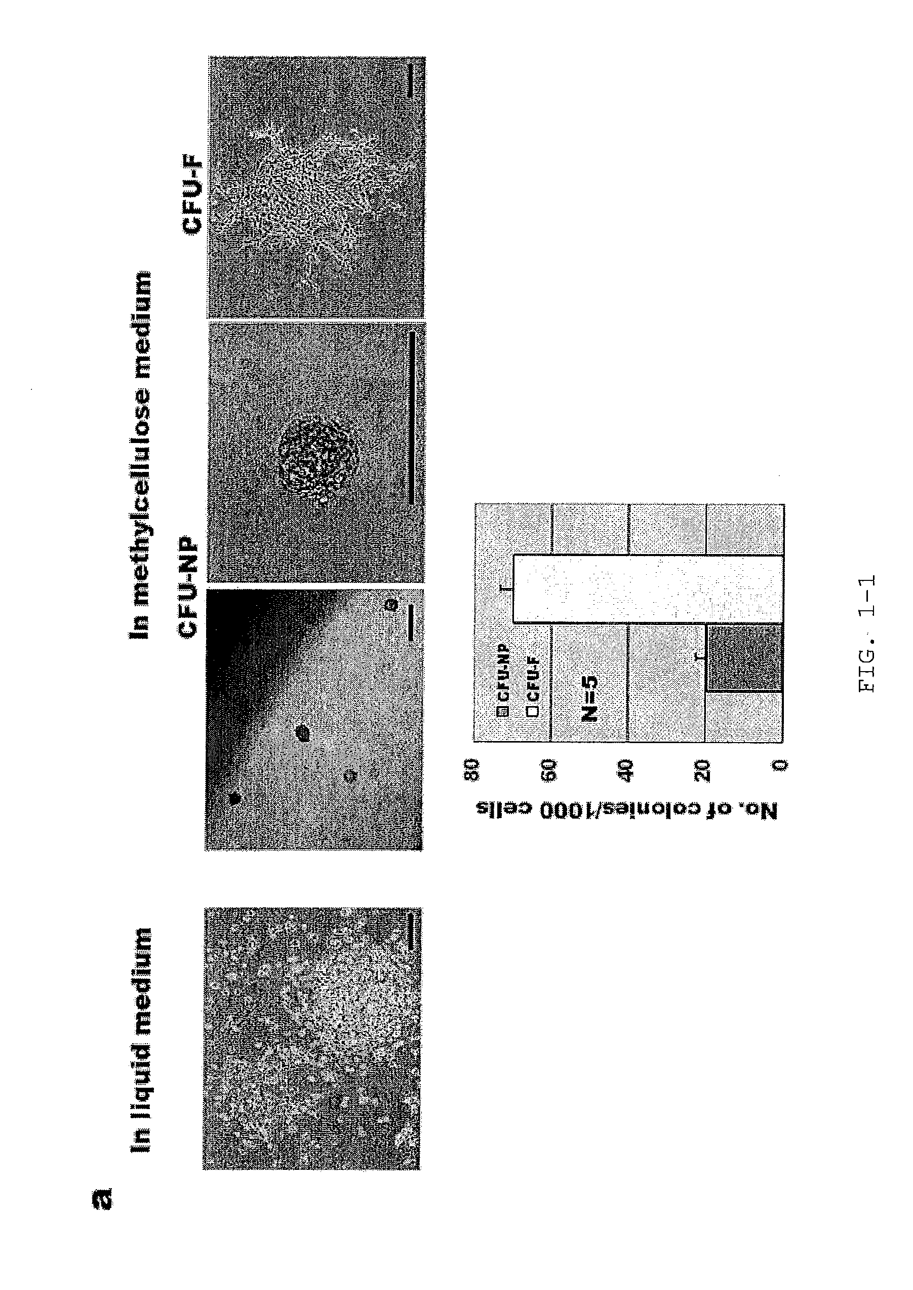 Intervertebral Disc Nucleus Pulposus Stem Cell/Progenitor Cell, The Cultivation Method And Intended Use Thereof