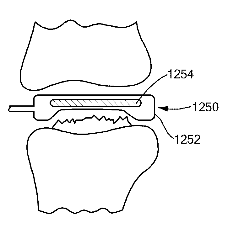 Joint Arthroplasty Devices and Surgical Tools