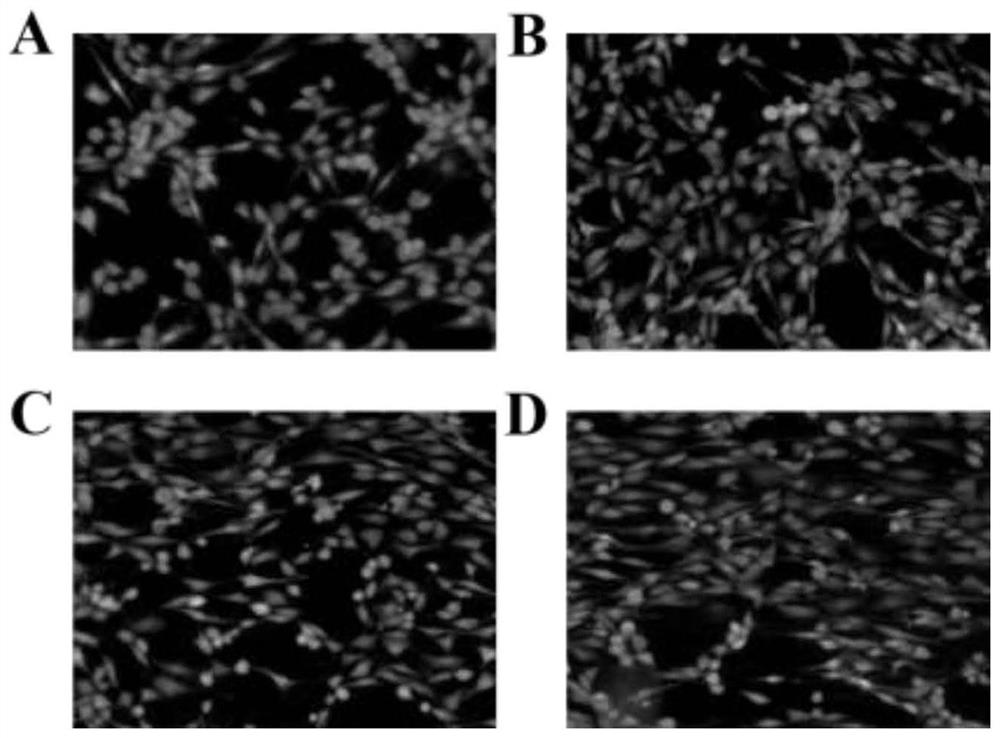 Inverse opal membrane for inhibiting scar generation and preparation method thereof