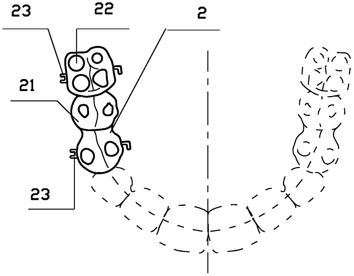 Fixed asymmetrical occlusal pad combined with cast crown to release interlocking device