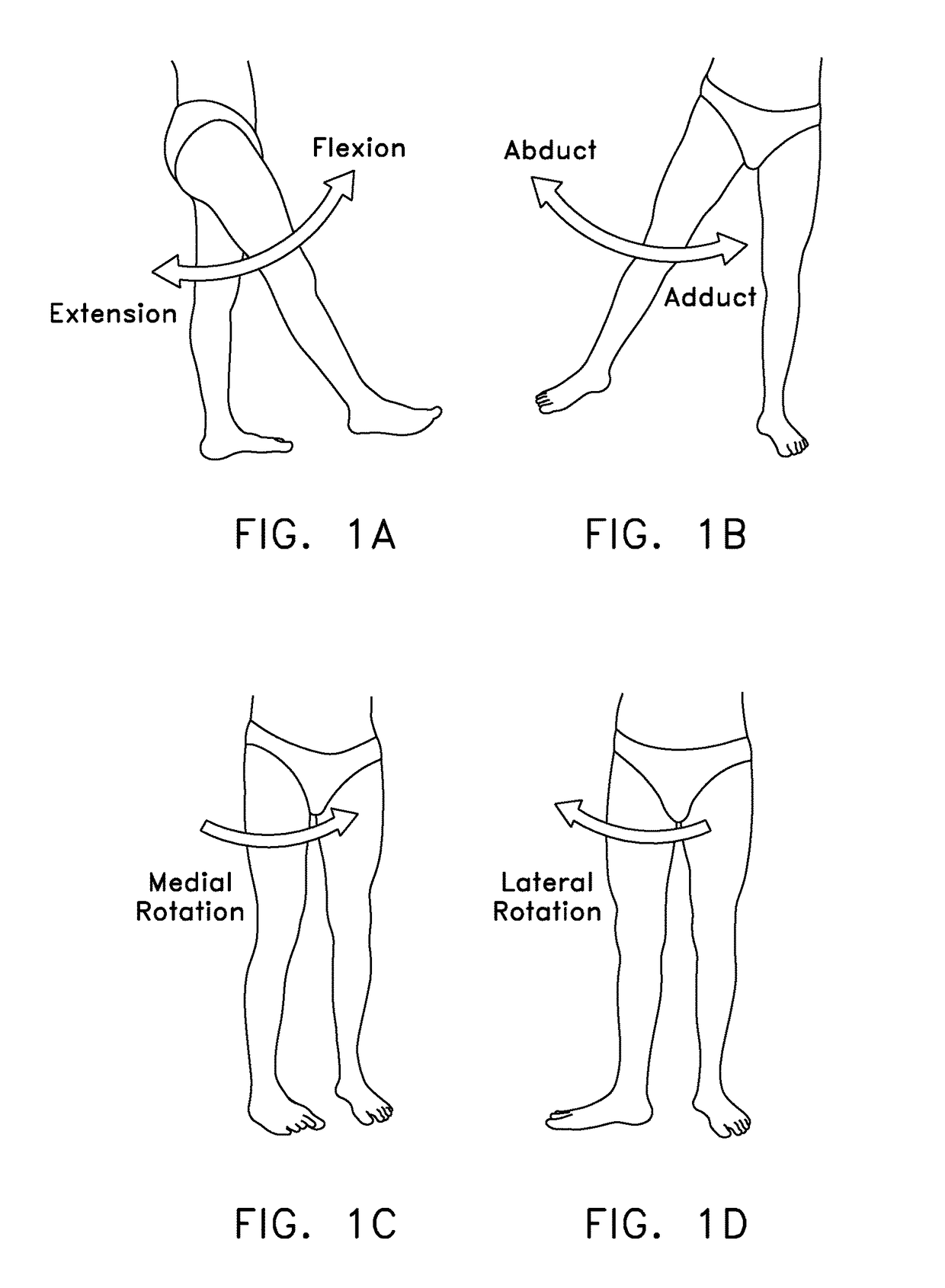 Method and apparatus for reconstructing a hip joint, including the provision and use of a novel arthroscopic debridement template for assisting in the treatment of cam-type femoroacetabular impingement