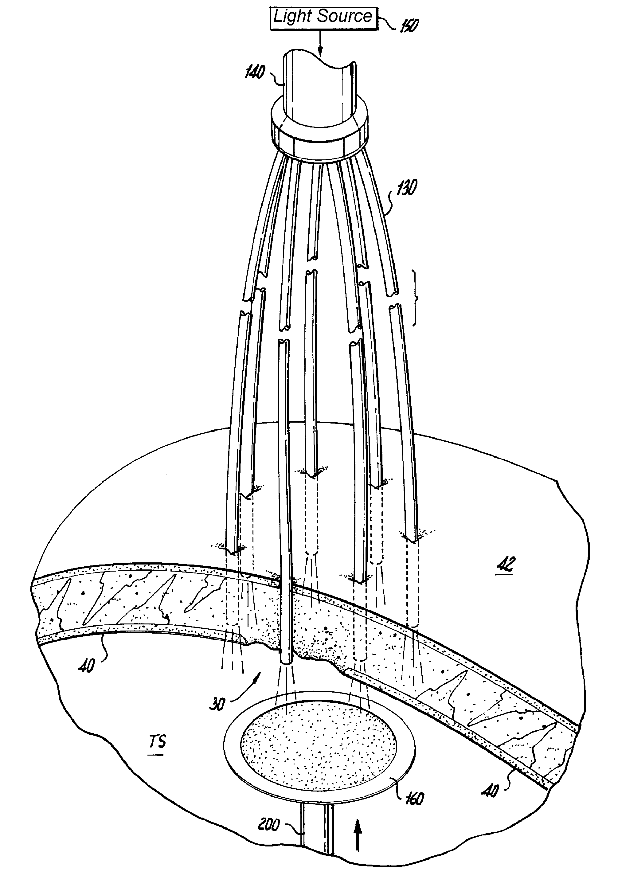 Methods of using light to repair hernia defects