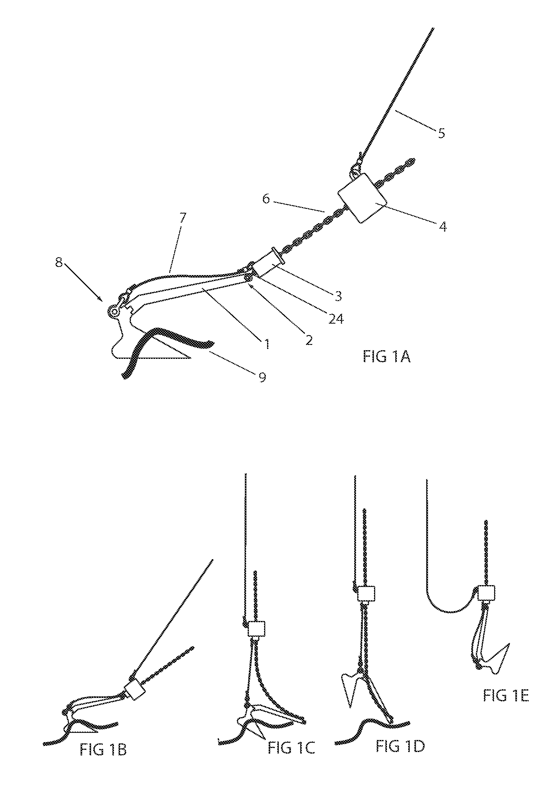 Anchor Retrieval System (ARS)