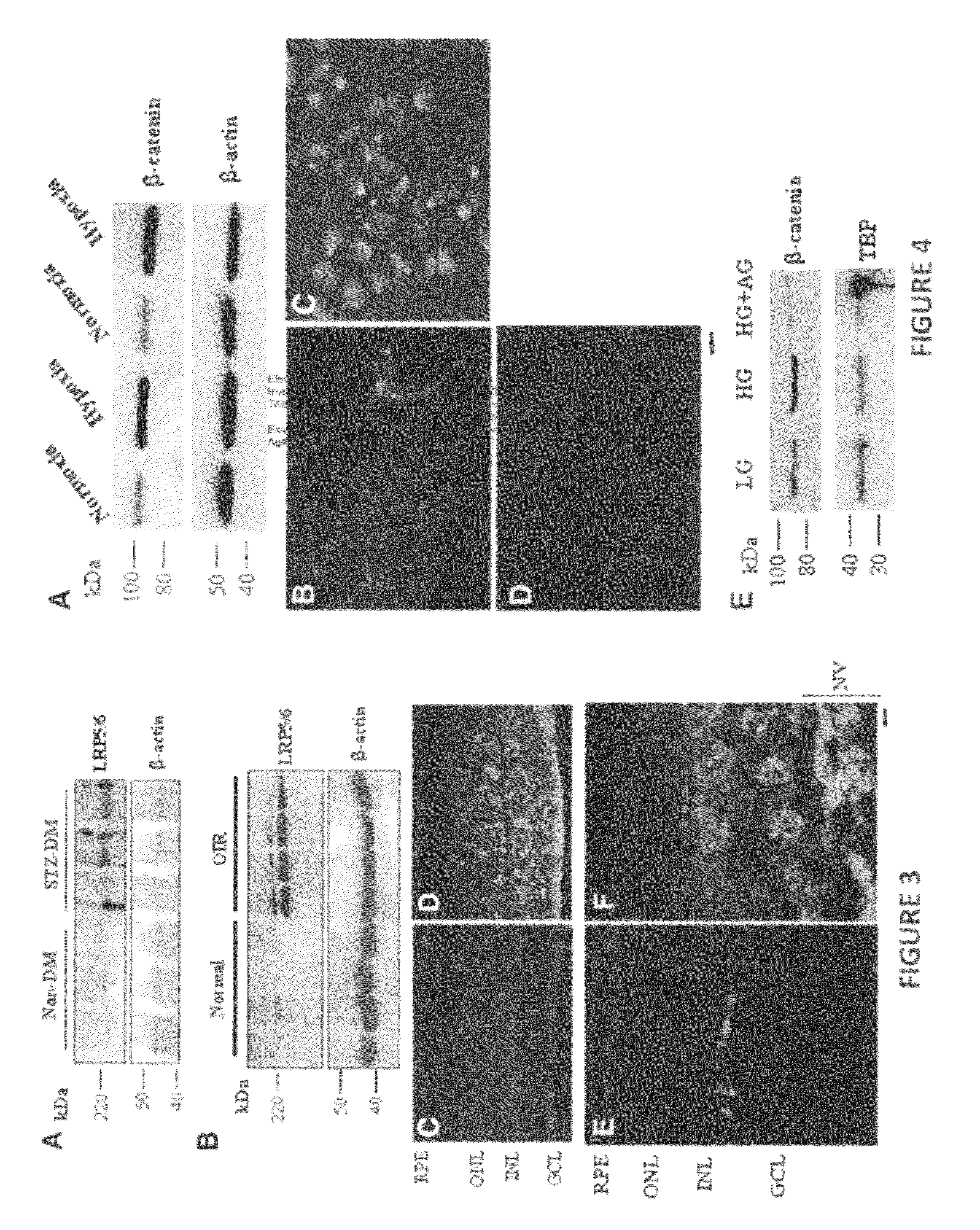 Monoclonal antibodies that inhibit the wnt signaling pathway and methods of production and use thereof