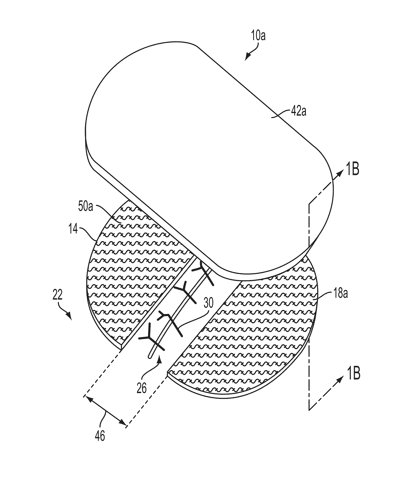 Apparatuses and methods for minimizing wound dehiscence, scar spread, and/or the like