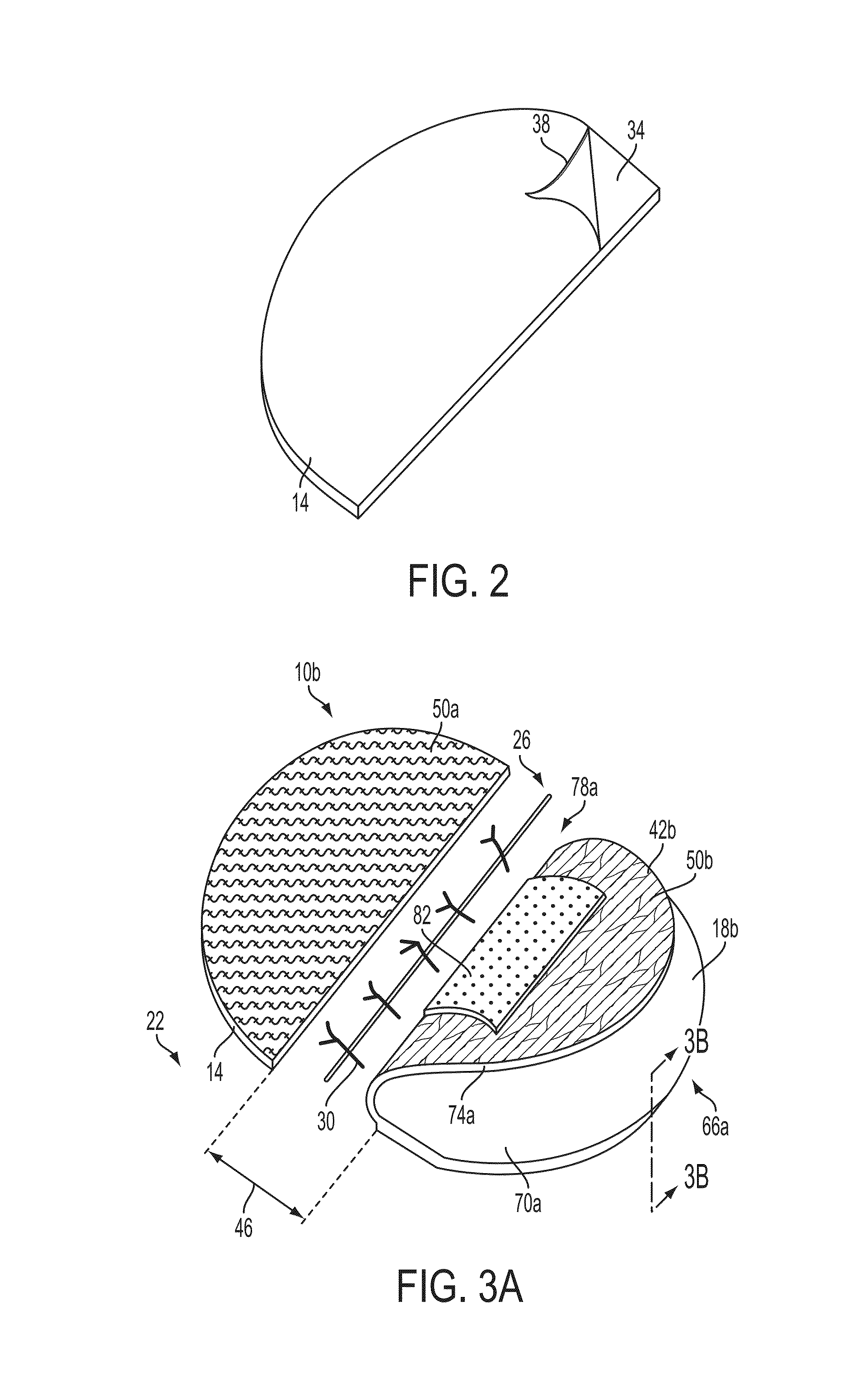 Apparatuses and methods for minimizing wound dehiscence, scar spread, and/or the like