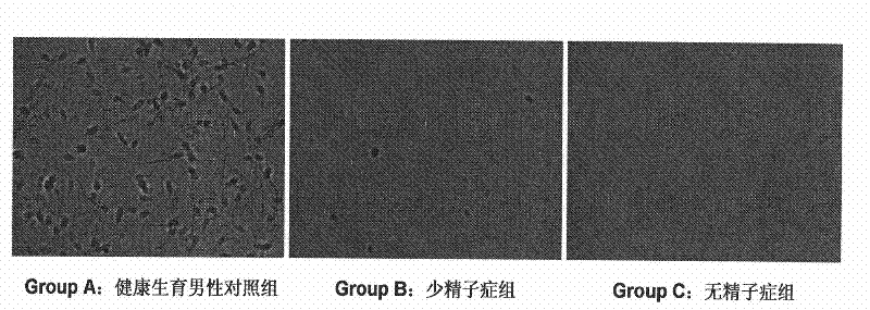 Seminal plasma micro ribonucleic acid marker related to spermatogenesis deficiency and application thereof