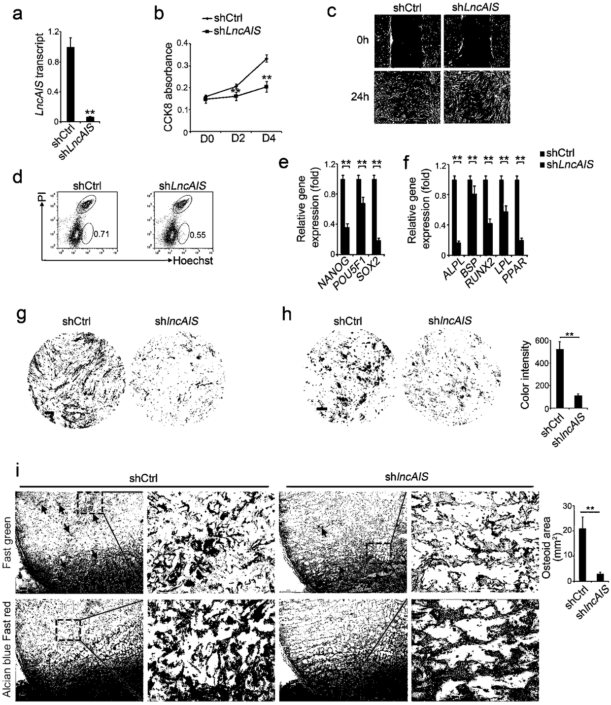 lncRNA marker lncAIS of adolescent idiopathic scoliosis (AIS) and application of lncAIS in preparation of AIS detection, prognosis, prevention or treatment products