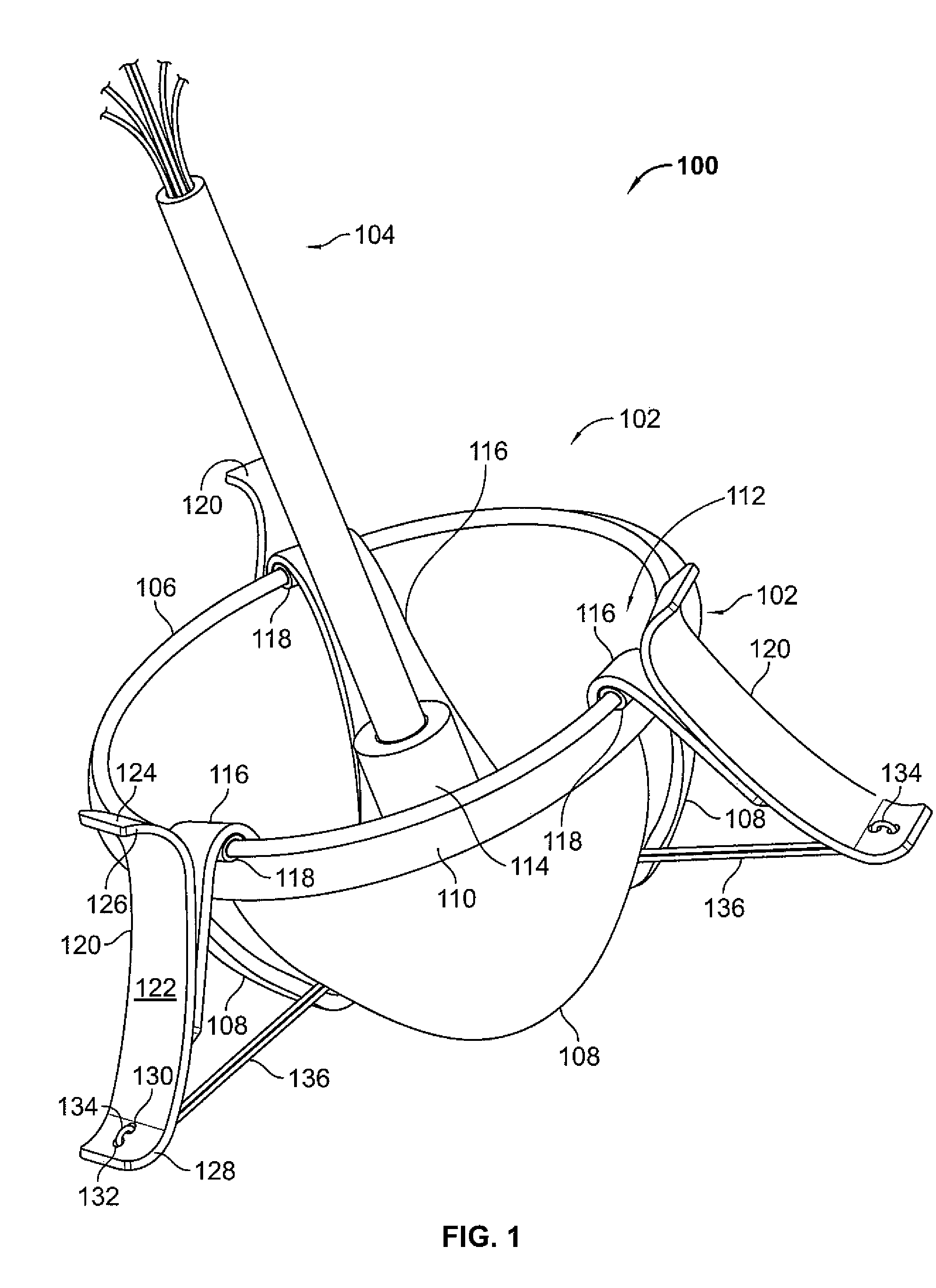 Mitral valve system