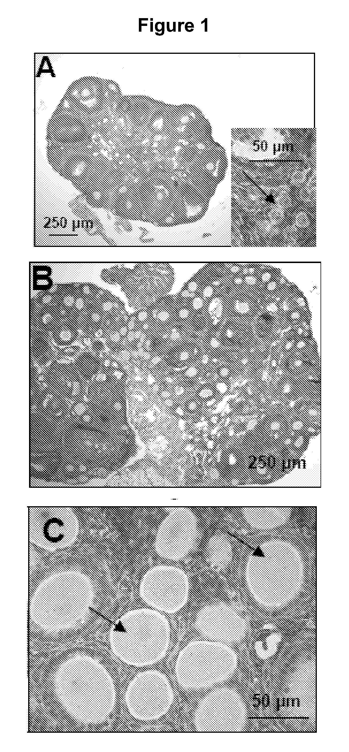 Methods for in vitro maturation of ovarian follicles