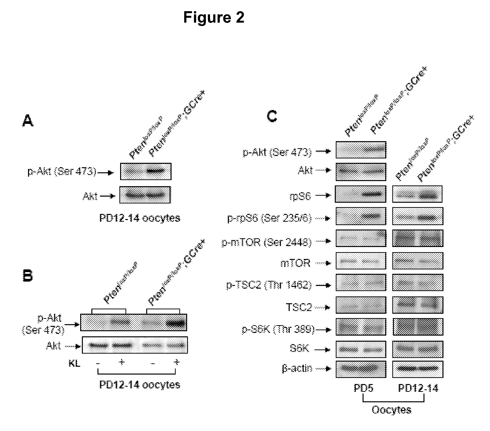 Methods for in vitro maturation of ovarian follicles