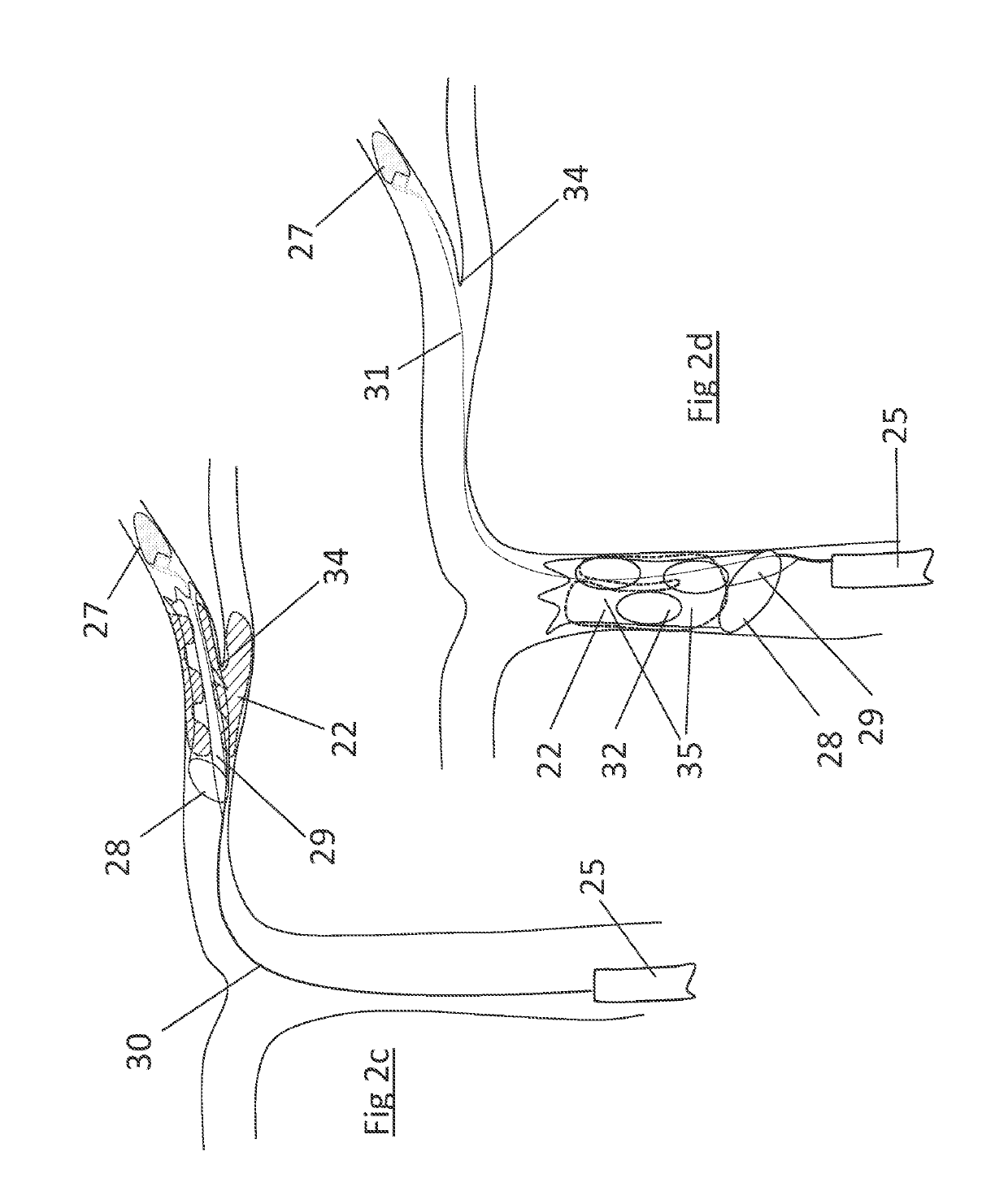 Clot retrieval device for removing clot from a blood vessel