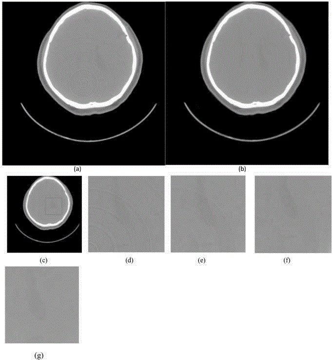 Ring artifact elimination method for CBCT image
