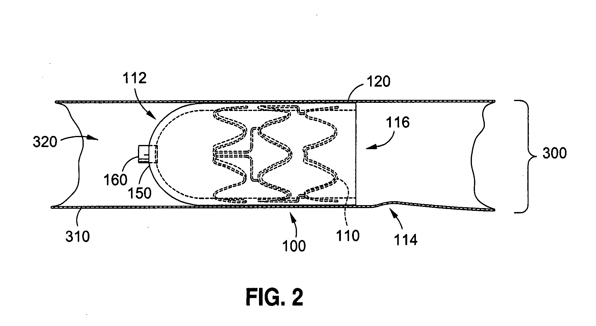 Methods and apparatus for rapid endovascular vessel occlusion and blood flow interruption