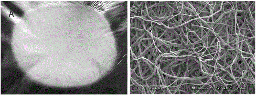 ASCs (Adipose Stem Cells) combined POC-PLA (Polycitrate-Poly Lactic Acid) electrostatic spinning patch complex as well as preparation method and application thereof