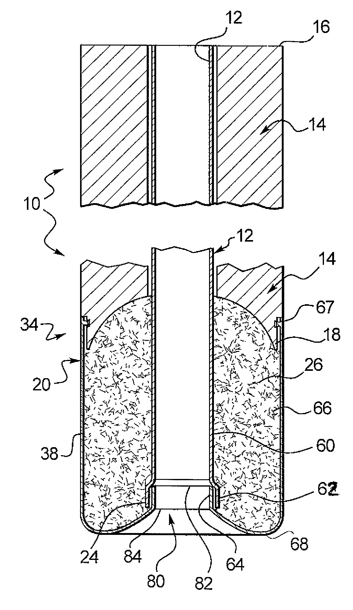 Apparatus and method for inhibiting blood loss