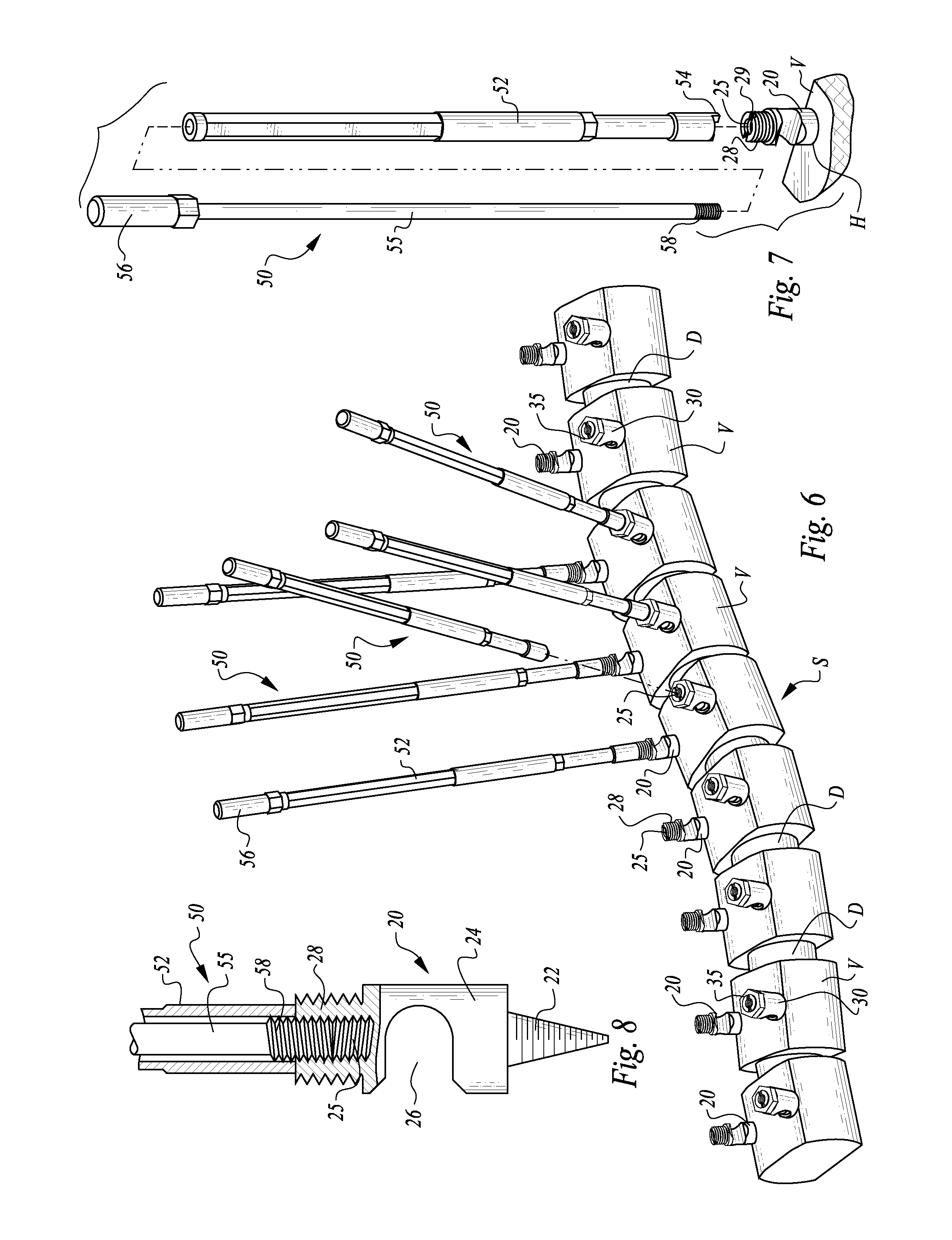 Table anchored scoliosis de-rotation system and method