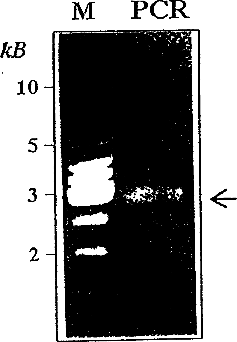 In vitro activity assay for human hepatitis B virus (HBV) DNA polymerase, and its use for screening inhibitors of HBV DNA polymerase