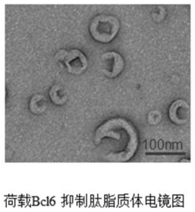 An immunomodulatory microsphere preparation targeting tumor-associated macrophages and its preparation method and application