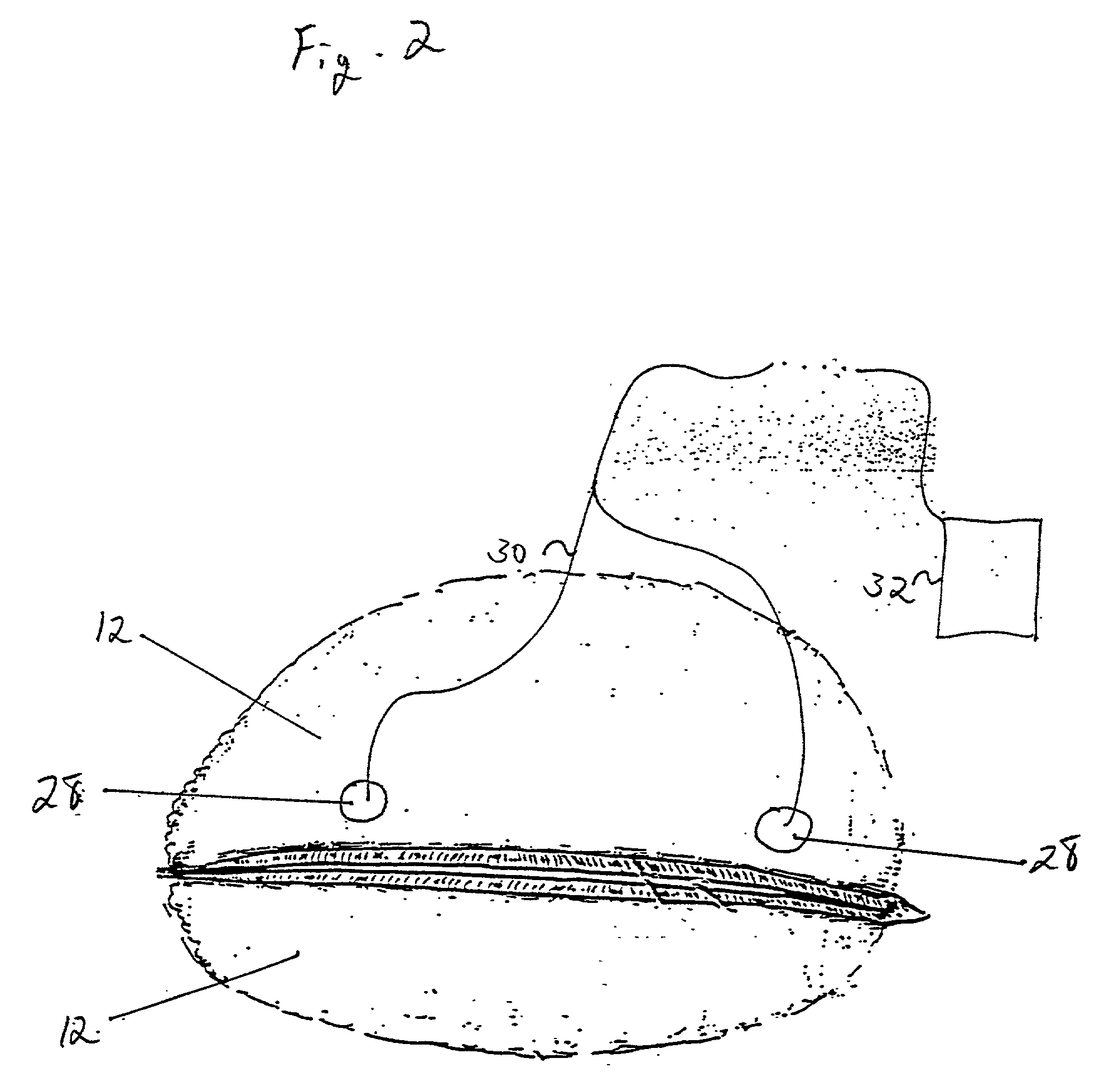 Method and apparatus for preventing and treating eyelid problems