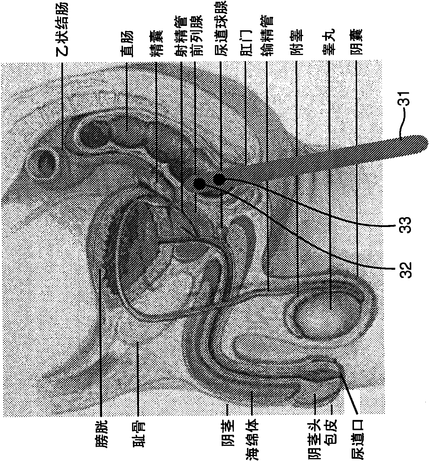 A system, device, method, computer-readable medium, and use for in vivo imaging of tissue in an anatomical structure