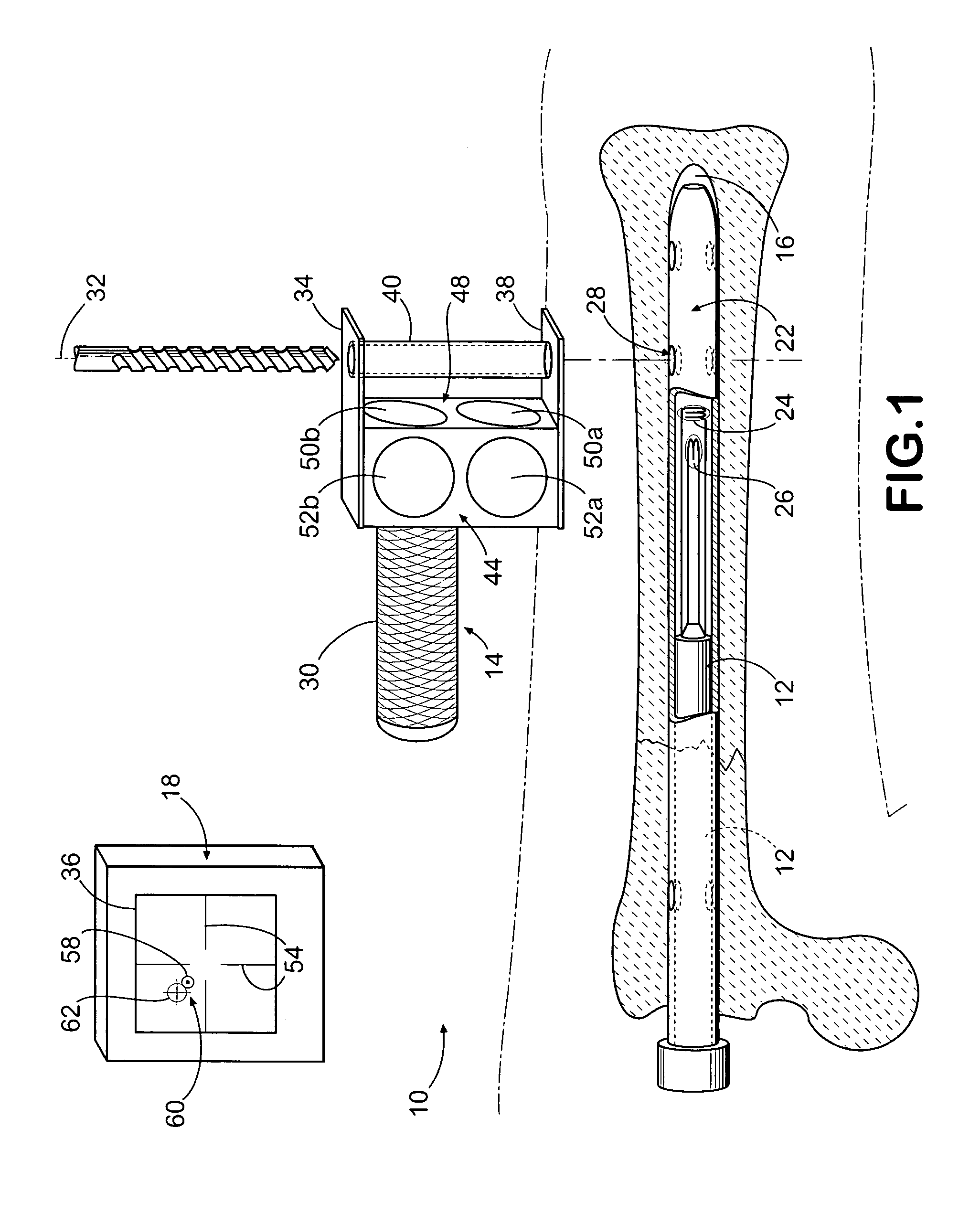 Method and apparatus for distal targeting of locking screws in intramedullary nails